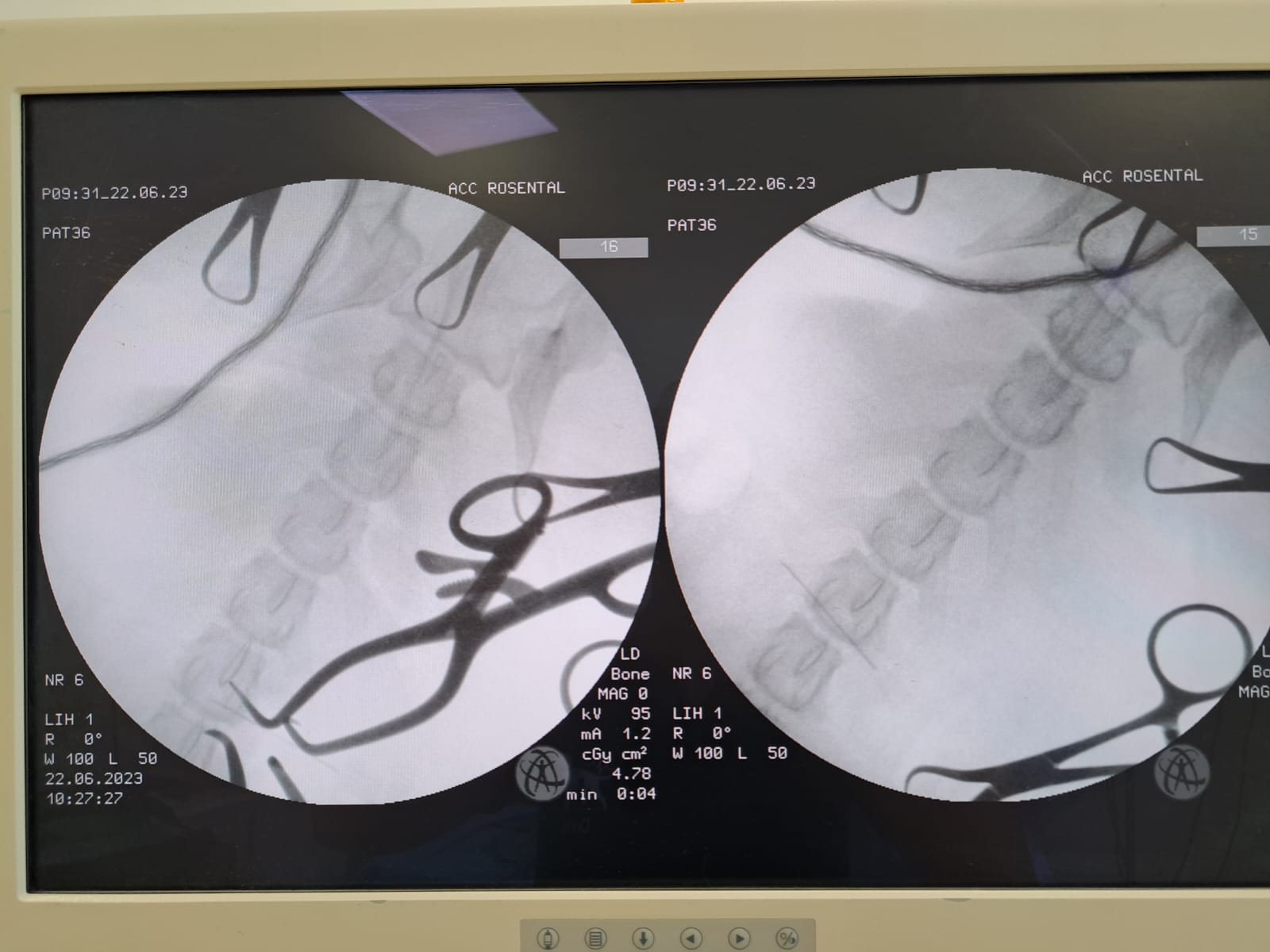 Bildgebung (Computertomographie)